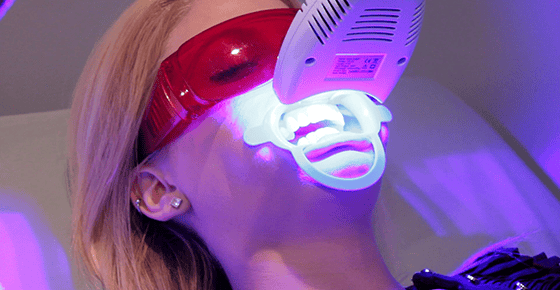 Teeth Whitening Mabank