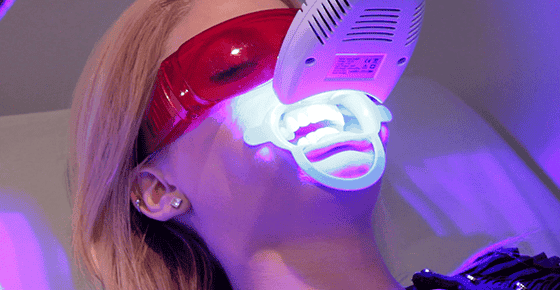 Teeth Whitening Mabank